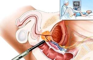 Methods for diagnosing prostatitis