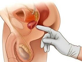 Prostate massage to treat male prostatitis