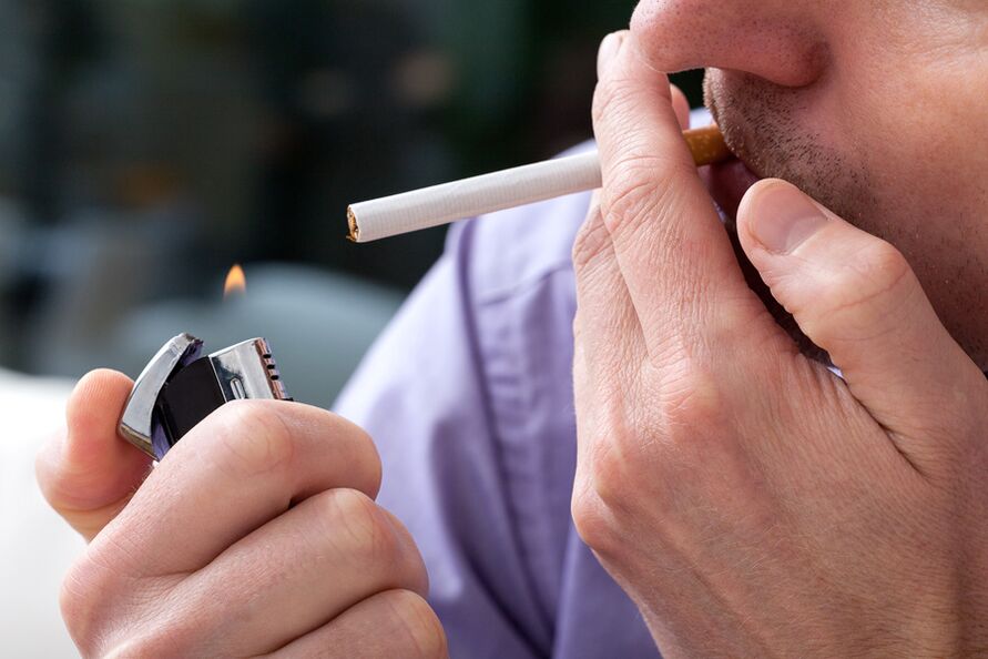 Smoking is a cause of chronic prostatitis