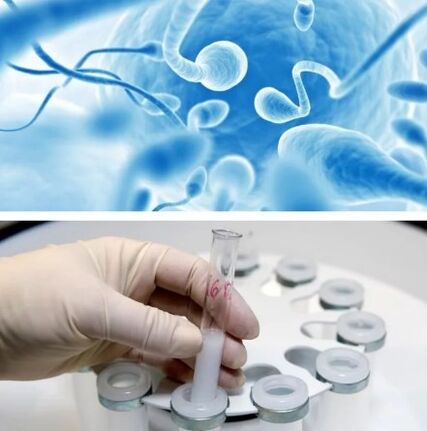 Sperm diagram
