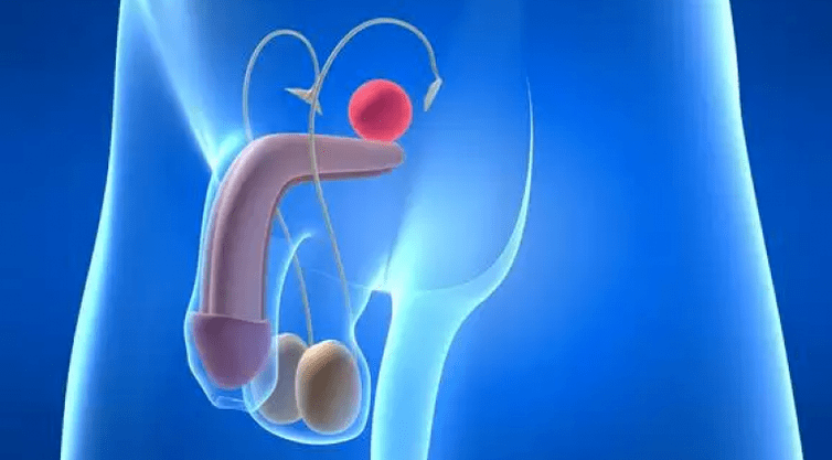 Prostatitis is an inflammation of the male prostate that requires complex treatment